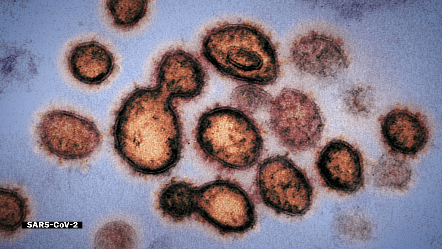 Coronavirus_Explained_LimitedSeries_Episode1_00_05_19_16.f3w2g7xm6